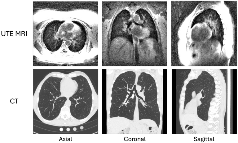ct_vs_mri_ghosh