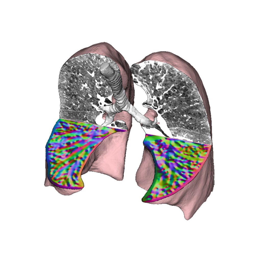 lung_gvf_cutout