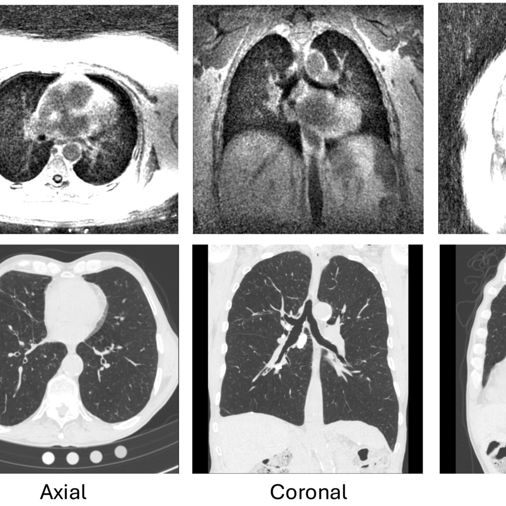 ct_vs_mri_ghosh