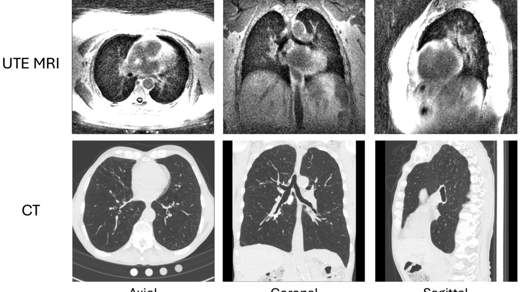 ct_vs_mri_ghosh
