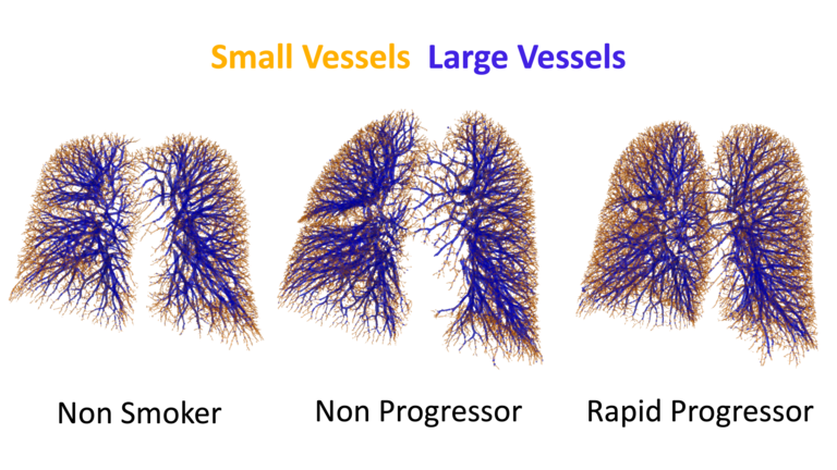 vessel